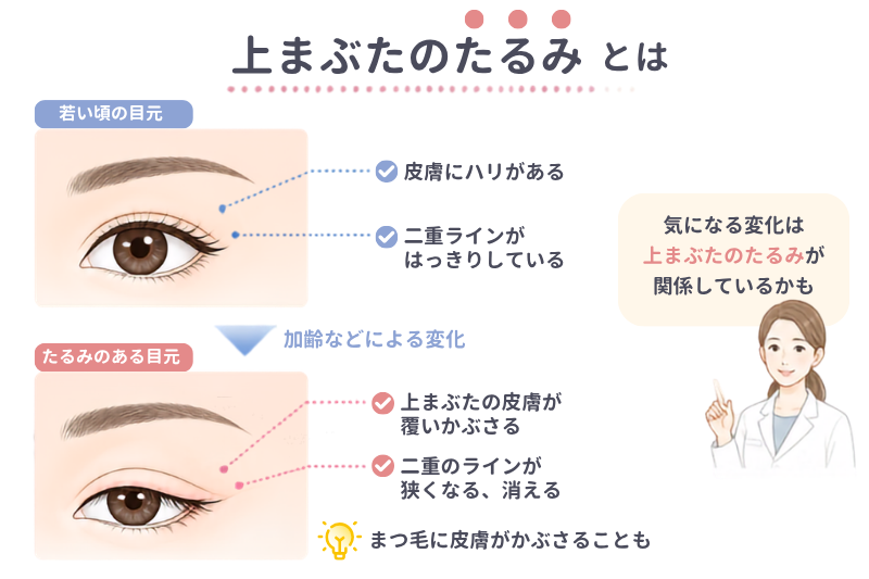 R.O.clinicの上まぶたたるみ切除